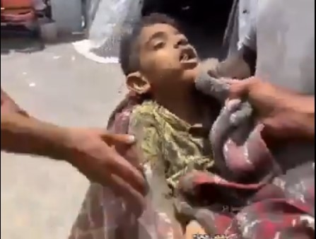 طفل فلسطيني استشهد ولا زال الطعام في فمه جراء العدوان الصهيوني على غزة